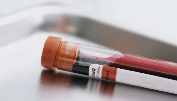 Додаткова діагностика