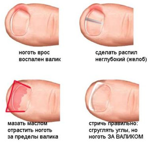 Це прості заходи, але вони виявляються дуже ефективними
