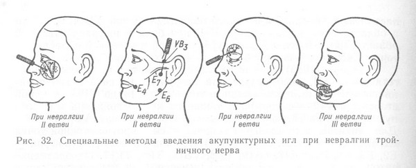 Блокування віддалених гілок