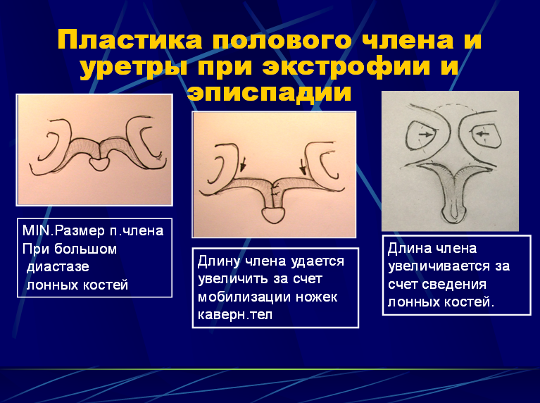 4)