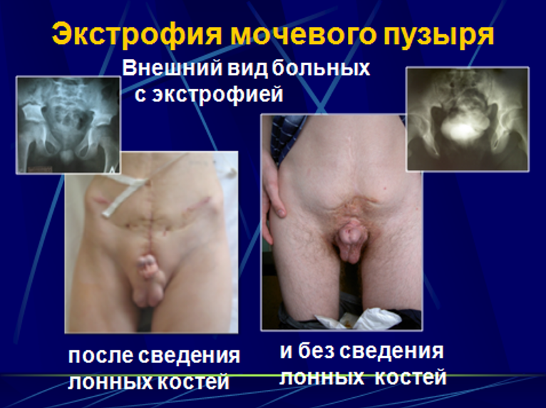 6)