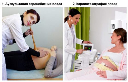 Основний показник життєздатності плода - це його серцебиття