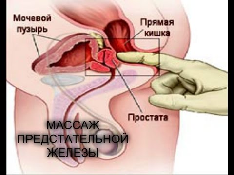 Масаж простати самостійно вдома Як самому зробити масаж простати стимулів