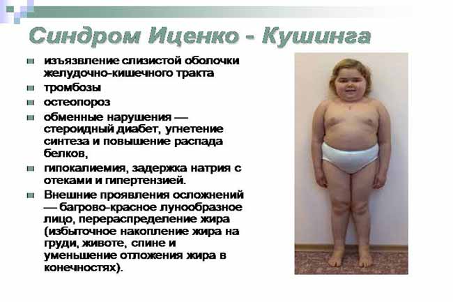 Розвиток хвороби Іценко-Кушинга