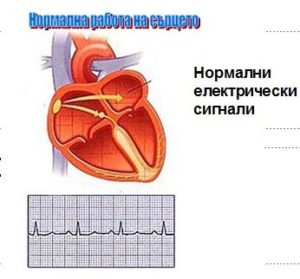 Этот тип аритмии встречается при заболеваниях сердца и при заболеваниях щитовидной железы, алкоголизме