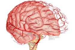 «Тендітні» судини головного мозку - це основна причина інсультів, при якому виникає розрив живлячих судин і крововилив