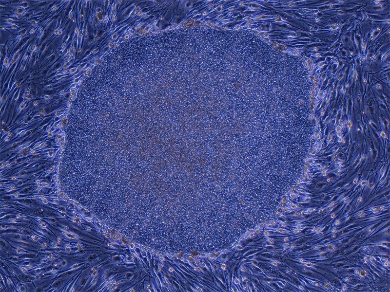 Колонія (група) iPS-клітин людини, вирощених з клітин фібробластів (сполучної тканини)