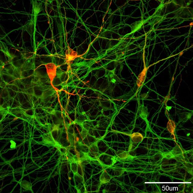 Клітини-виробники допаміну, отримані за допомогою ініціації перетворення iPS-клітин людини (фотографія надана Морідзане Асука з Цетру досліджень iPS-клітин Кіотського університету)
