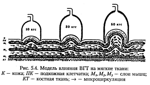 Локальне вплив градієнтів тиску посилює проникність фенестрированного ендотелію мікросудин, особливо в області Вилз