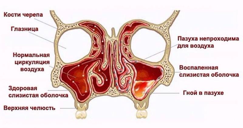 Через ці соустя секрет, що утворився в пазусі, виводиться з носової порожнини при сморкании