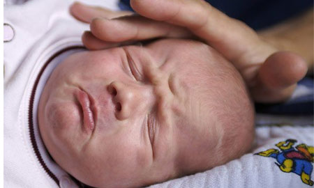Фото: Внутрішньочерепний тиск у новонародженого