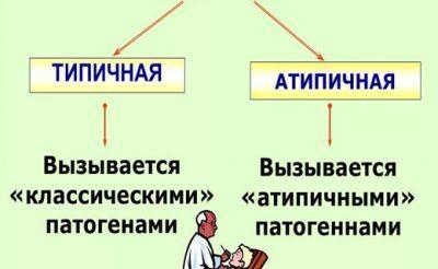 Пневмонія - це небезпечне захворювання, при якому вражається легенева тканина і відбувається скупчення ексудату в області альвеол