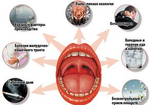 Білі плями в горлі можуть з'явитися через гнійного тонзиліту, який по-іншому називається фолікулярна або лакунарна ангіна