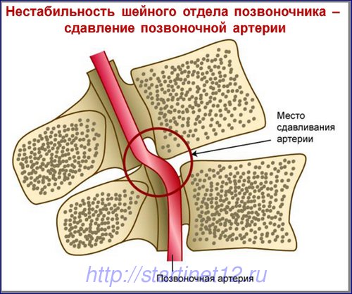 А іноді для людей недосвідчених малюють взагалі ось такі картинки: