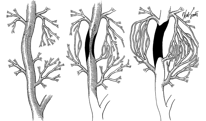 Але запас по міцності є, і кров при наявності незначних проблем, може знайти собі маршрут обходу проблемних місць