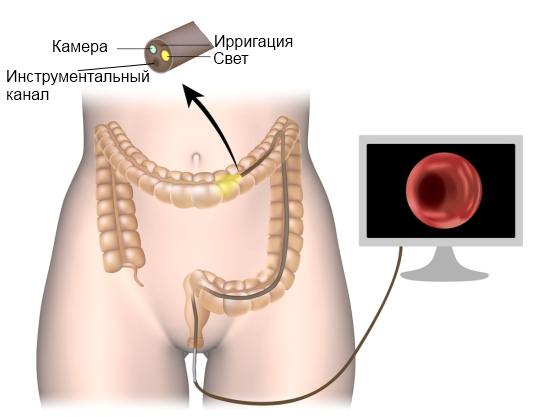 У сучасній медицині існує багато різних лабораторних та апаратних дослідницько-діагностичних методів та процедур, які використовуються для ефективного виявлення патологічних станів і захворювань