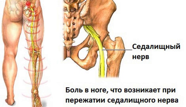 У кожної людини два таких органу нервової системи, які проходять через отвори в тазових кістках від хребта разом з найбільшими судинами ніг через отвори в тазових кістках, сідничні м'язи вниз до коліна, звиваючись в тісному каналі з розвинених м'язів стегна і його зв'язок