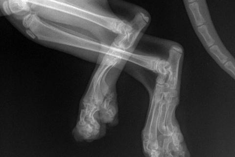 Нижче представлені рентгенівські знімки з характерними ознаками хондродисплазія