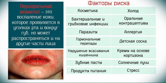 установкою зубних протезів;   використанням зубних паст з великою кількістю фтору;   застосуванням косметичних засобів, що містять велику кількість Ізопропілміристат, лаурилсульфата натрію;   алергічний риніт, бронхіальну астму, що носять хронічний характер;   зміною клімату з прохолодного на жаркий;   використанням кремів і мазей з кортикостероїдами