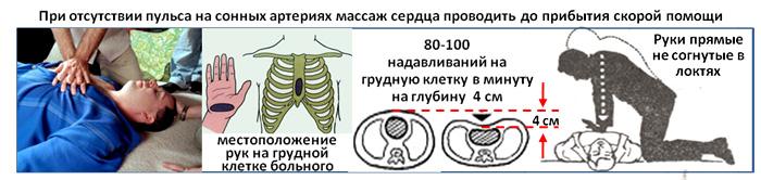 Крім того, доцільно щоб Ваші родичі, які проживають разом з Вами оволоділи елементарними навичками серцево-легеневої реанімації, визначення частоти пульсу на сонних артеріях і вимірювання артеріального тиску