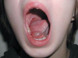 Підкріпити дію лікарських препаратів зможуть народні засоби, якими кожен зможе скористатися самостійно